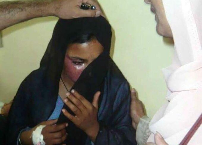 25 वर्षीय ईसाई महिला ने विवाह प्रस्ताव ठुकराया, सियालकोट🇵🇰 में जिंदा जला दी गई