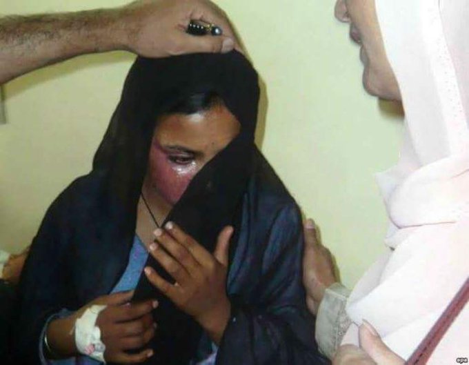 25 वर्षीय ईसाई महिला ने विवाह प्रस्ताव ठुकराया, सियालकोट🇵🇰 में जिंदा जला दी गई