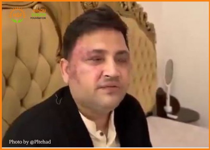 🚨 विशाल कुमार के खिलाफ क्रूरता: सिंध 🇵🇰 में न्याय, कानून और मानवता की परीक्षा